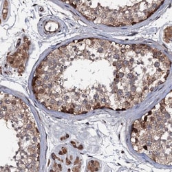 RRP1 Antibody, Novus Biologicals:Antibodies:Primary Antibodies